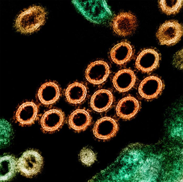 Swine Flu